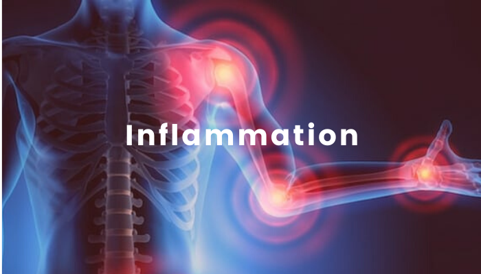 Dealing With Inflammation